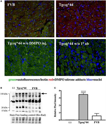 Immuno-Spin Trapping-Based Detection of Oxidative Modifications in Cardiomyocytes and Coronary Endothelium in the Progression of Heart Failure in Tgαq*44 Mice